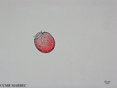 phyto/Brazilian_Nordeste/AtoldasRocas_station22/ABRACOS1 October 2015/Metaphalacroma skogsbergii (Snap-2066)(copy)_thumb.jpg